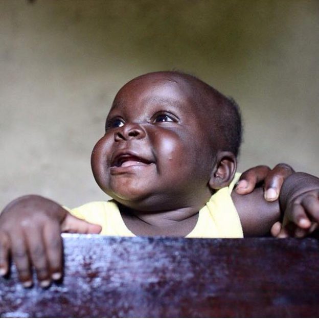 Famine in Uganda